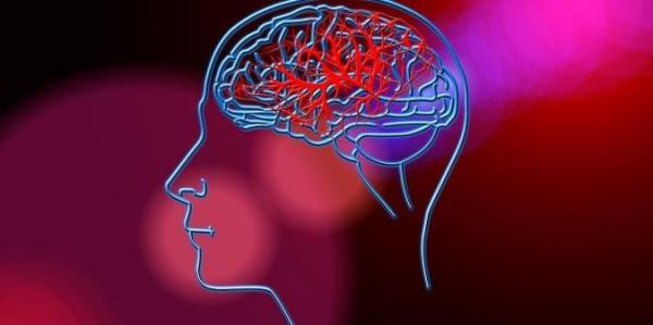 به چه دلیلی سکته مغزی رخ می دهد؟ عوارض سکته و نحوه جلوگیری از آن