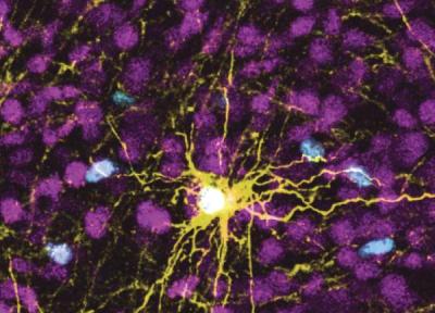 دانشمندان سلوهای مغزی انسانی را درون مغز موش ها پرورش دادند ، راهی تازه برای آنالیز اختلالات روانپزشکی